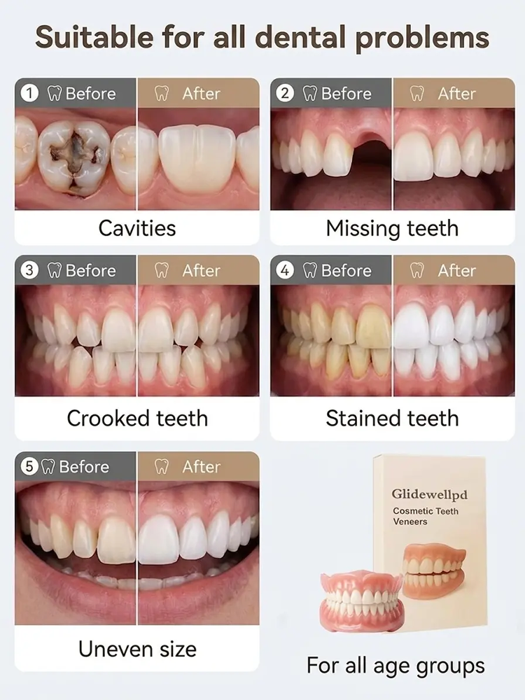 😁 Få ett perfekt vitt leende på 5 minuter – Utan tandläkare! 🎉