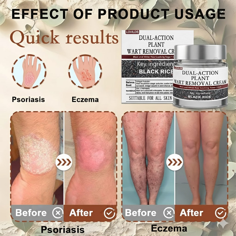 Black Rice Skin Repair Essence Cream ⚕️ FDA-certifierad (tar bort vårtor och hudutväxter, förbättrar keratinuppbyggnad och seborroiskt eksem, follikulär keratos, åldersfläckar och blåmärken)