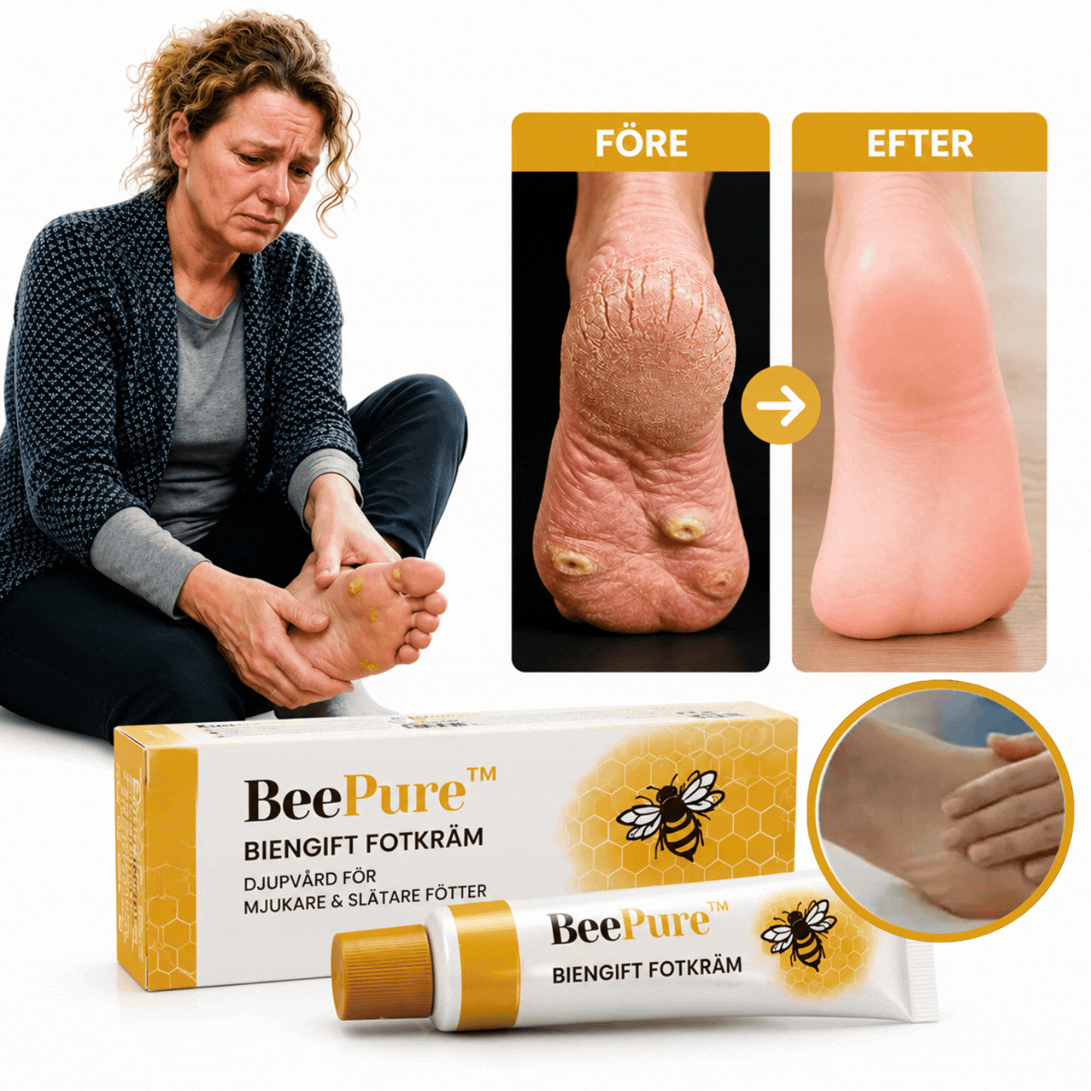 BeePure™ | Eliminera förhårdnader & liktornar med 92 % inom 2 dagar!