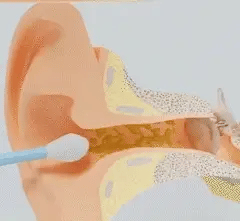 🧼👂 Smart ørerenser – Avanceret teknologi til renere og sikrere ører! (Sæt med 8 dele)