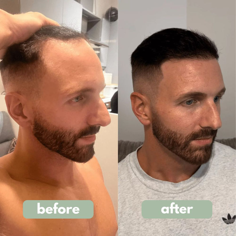 ✨💇‍♀️Få det fyldigere hår, du altid har drømt om