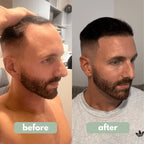 ✨💇‍♀️Få det fyldigere hår, du altid har drømt om