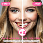 ✨ Oppnå et Strålende Smil – Kjøp 1 Få 1 GRATIS – 🦷 Niacinamid Whitening Tannkrem – For Sunnere, Hvitere Tenner!