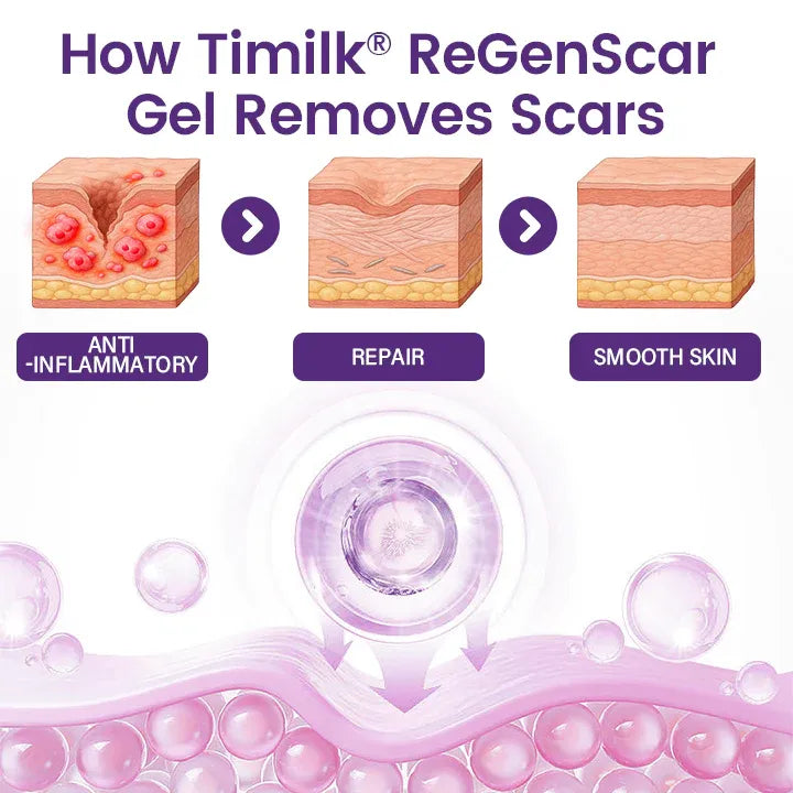 🌟🌟TiMilk - ReGen Gel for reparasjon av stamceller mot arr (importert)